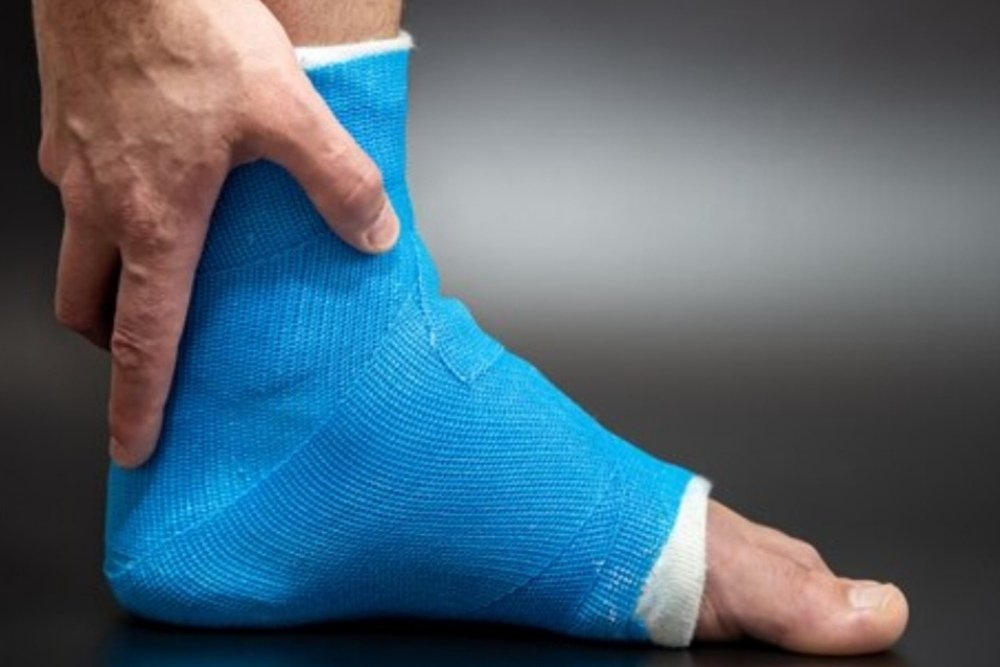 escayola azul tobillo lesionado tratamiento escayola azul tobillo lesionado tratamiento