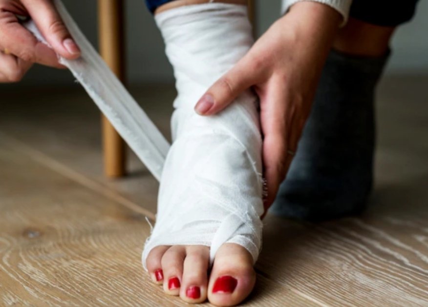 vendaje pie lesionado fisioterapia recuperacion