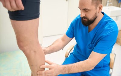 Linfedema: síntomas, causas y tratamiento fisioterapéutico en Madrid
