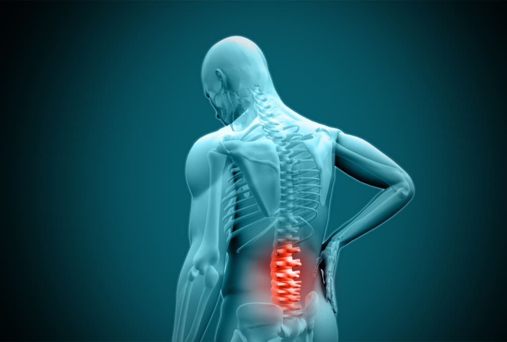 fisioterapia para ciatica y dolor lumbar en madrid anfis